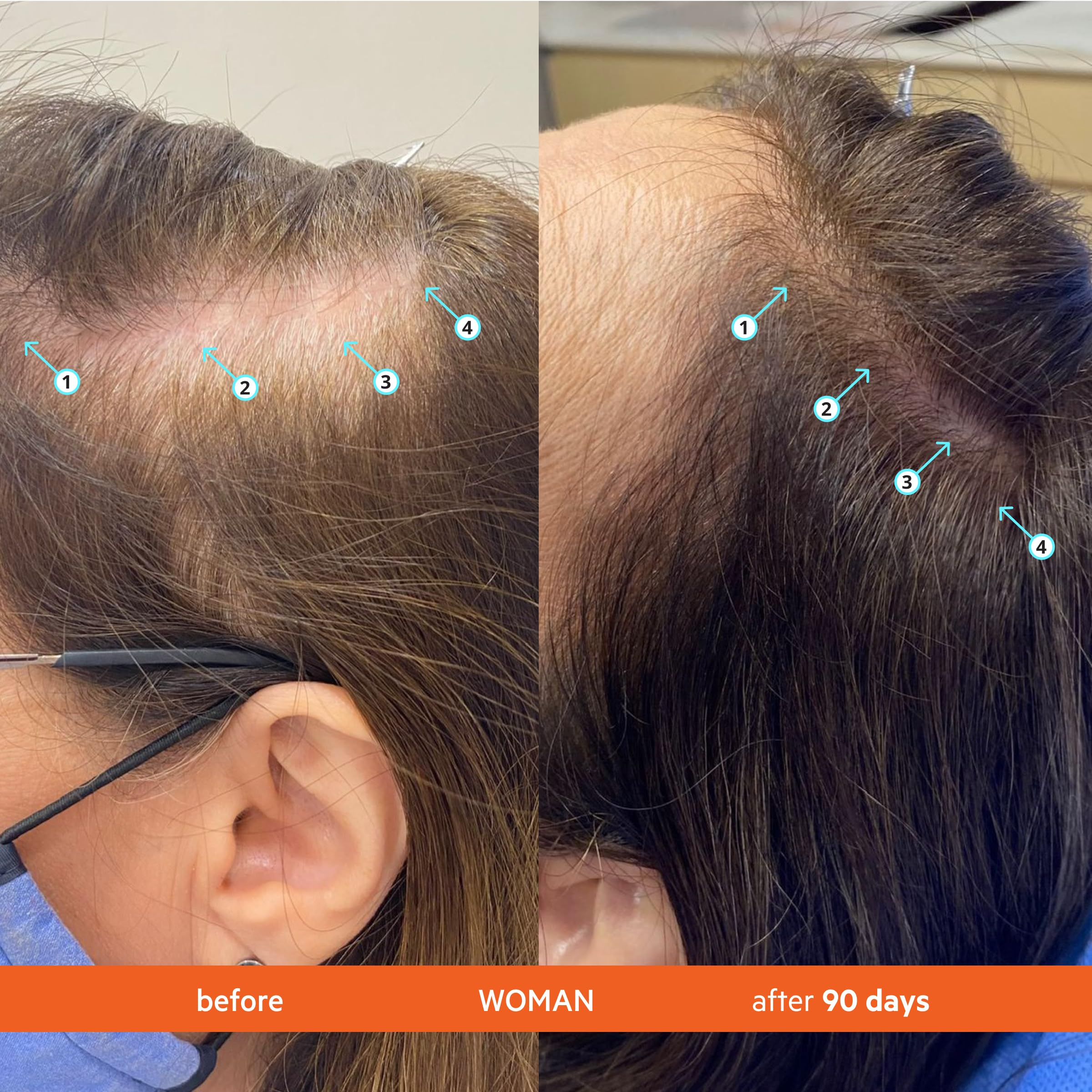 DS Laboratories Revita aplicación diaria para cabello renovado durante la ducha