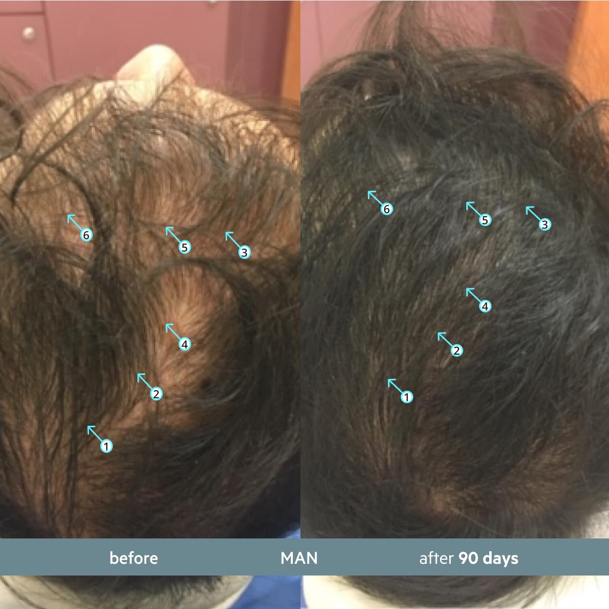 DS Labs Revita.SOD: zinc y ashwagandha para apoyar la vitalidad capilar.