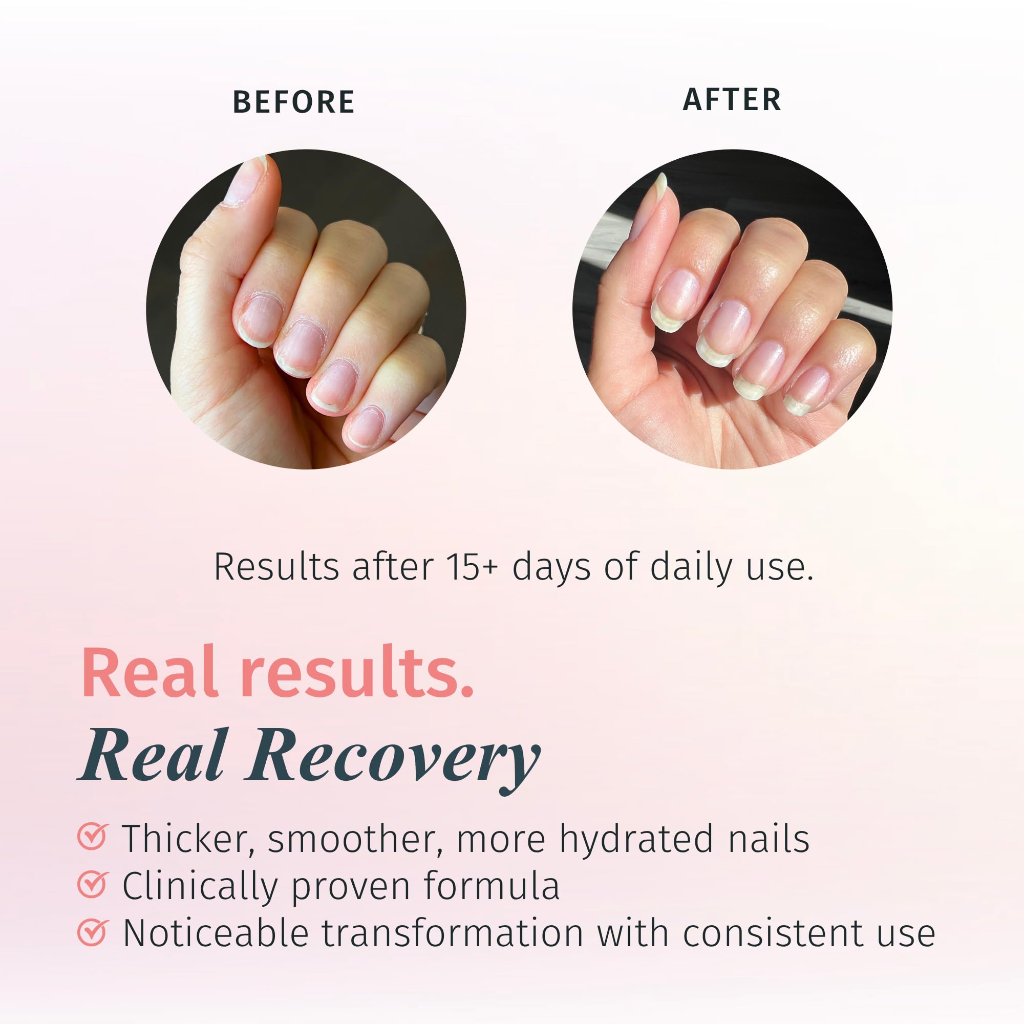 duri Rejuvacote 1: capa superior para sellar uñas y prolongar la manicura