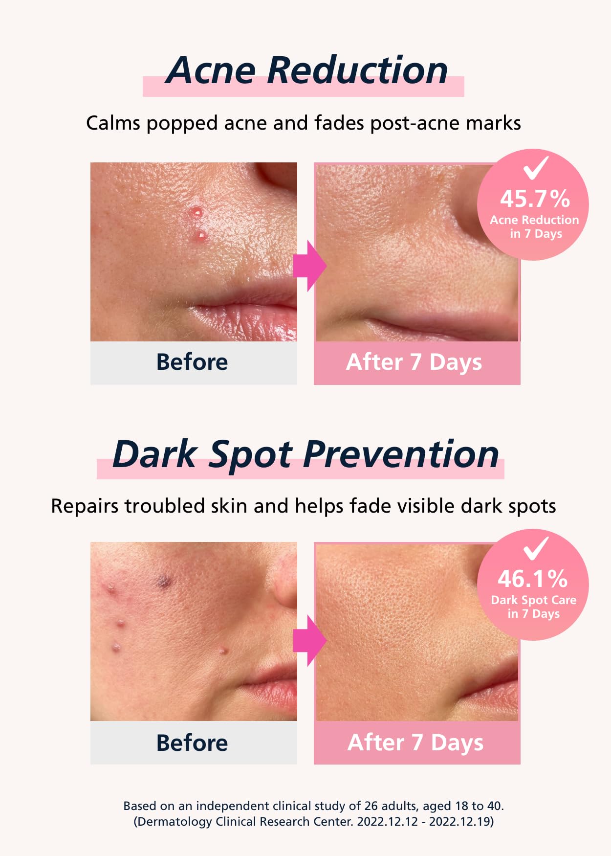Niacinamida y ácido hialurónico en DWEasyDerm para hidratación suave.