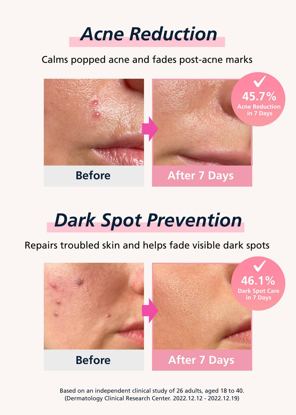 Niacinamida y ácido hialurónico en DWEasyDerm para hidratación suave.