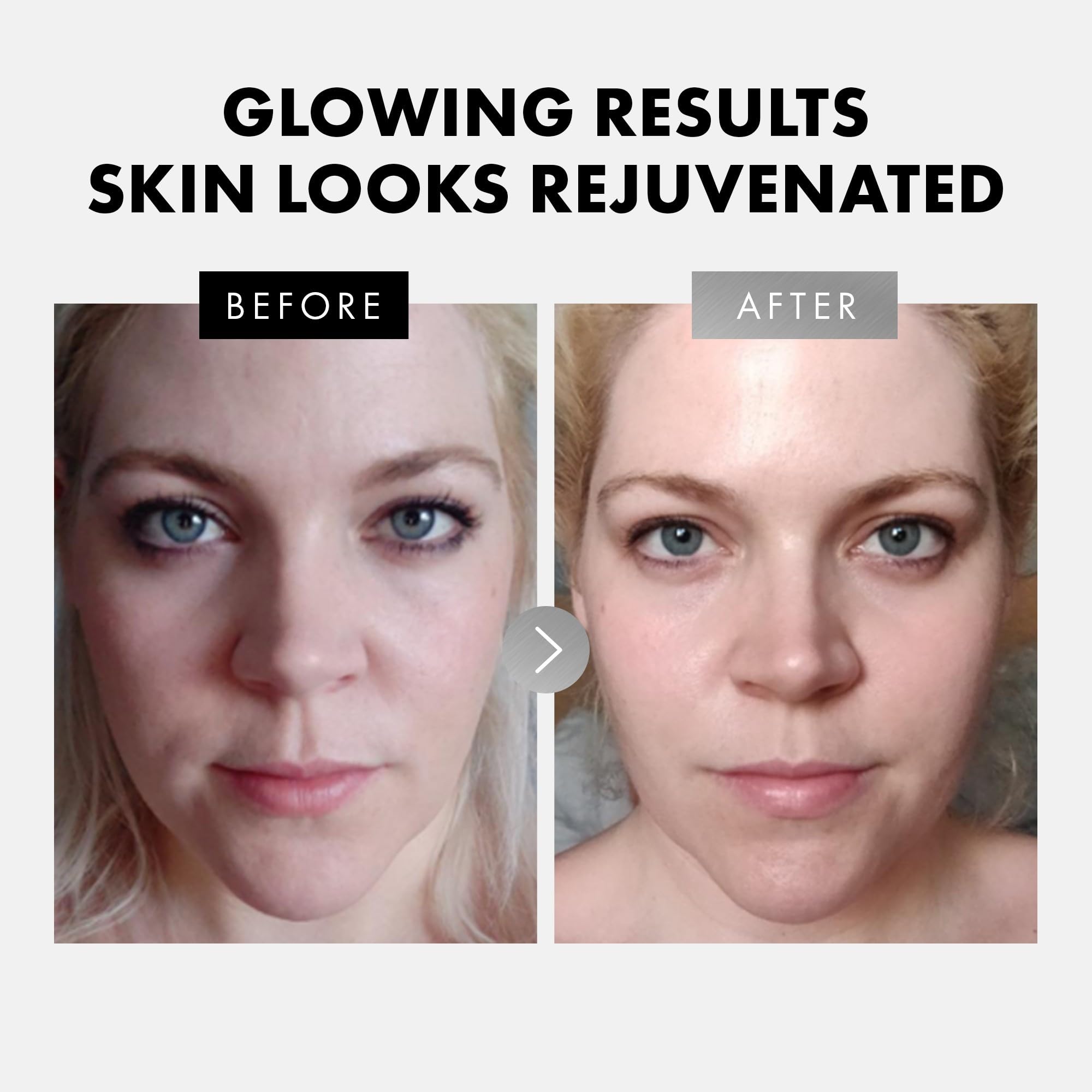 Eclat Skincare Ácido Hialurónico, gotas, mejora hidratación y firmeza.