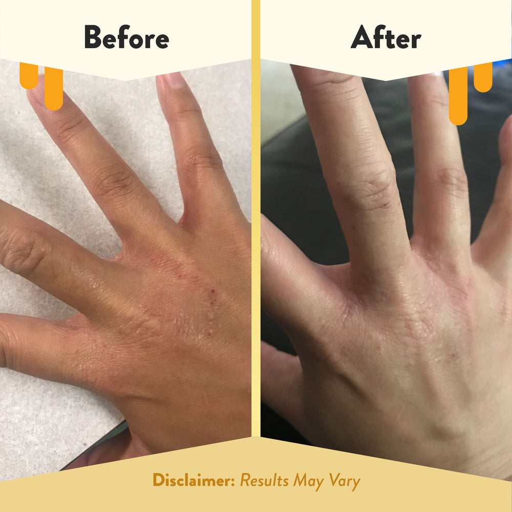ECZEMA HONEY: cuidado diario de la piel con textura ligera