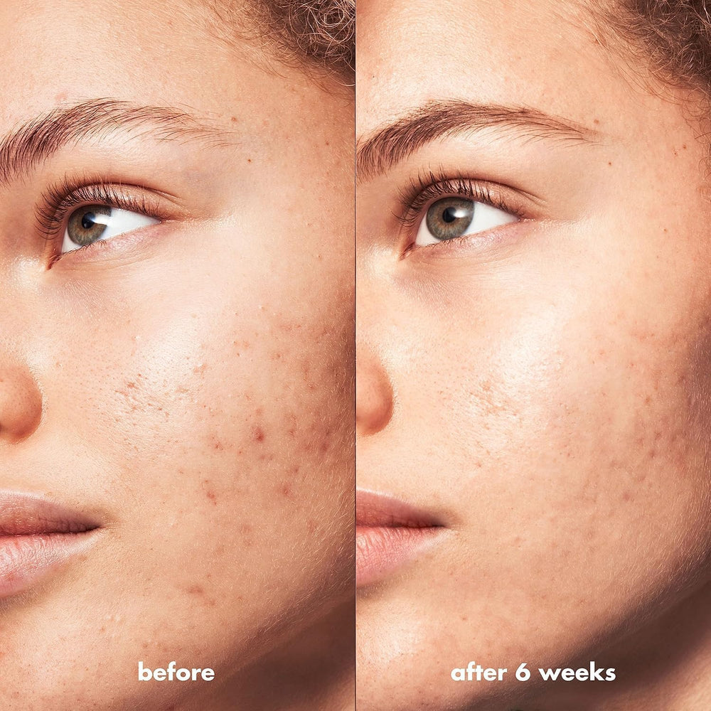 e.l.f. SKIN Blemish Breakthrough, tapón seguro para cuidado nocturno.