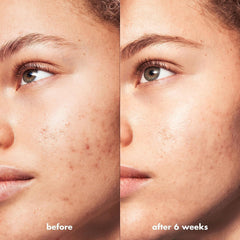 e.l.f. SKIN Blemish Breakthrough, tapón seguro para cuidado nocturno.