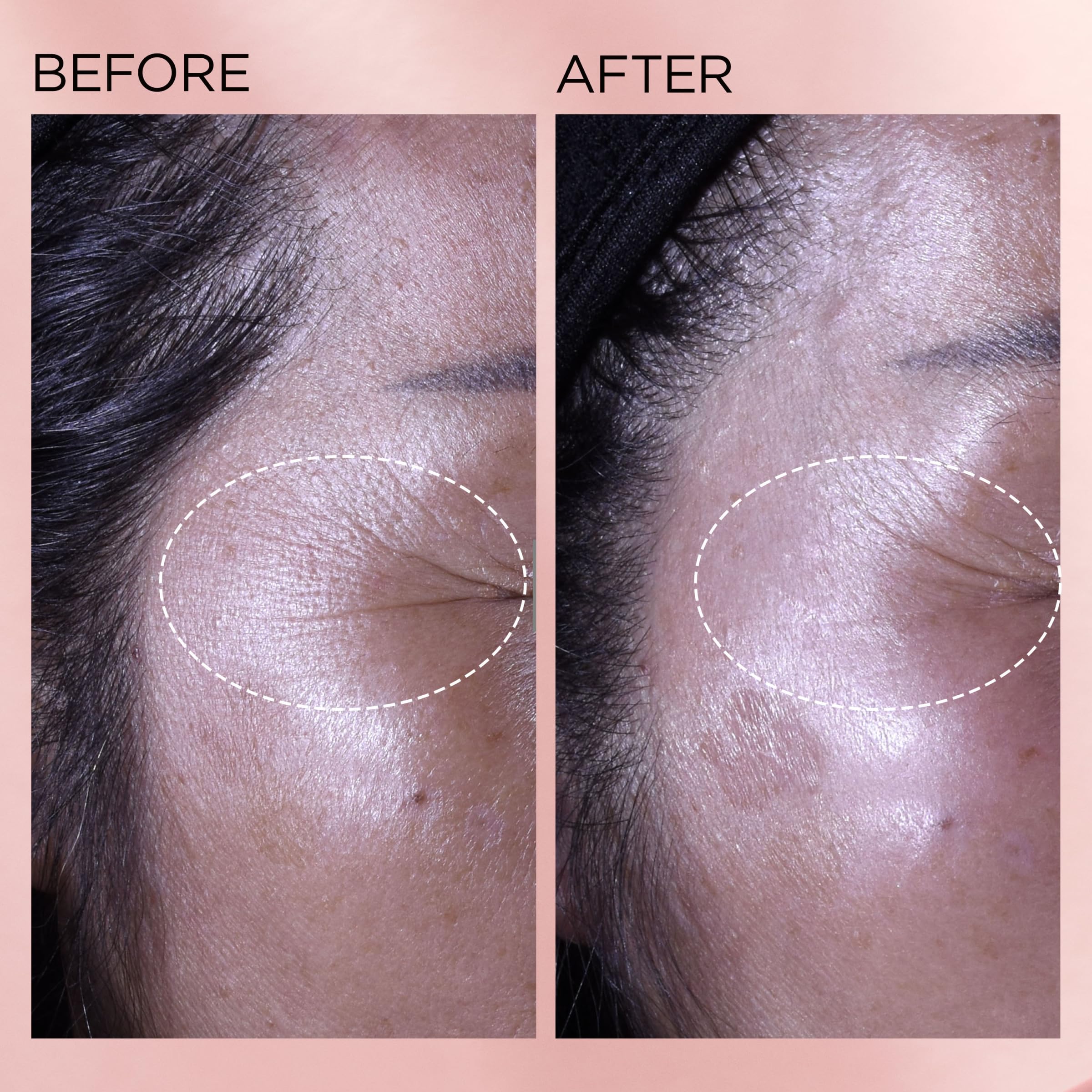 Elizabeth Arden potencia 10x del retinol puro gracias a HPR