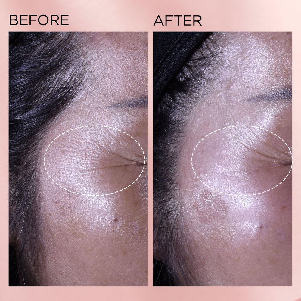 Elizabeth Arden potencia 10x del retinol puro gracias a HPR