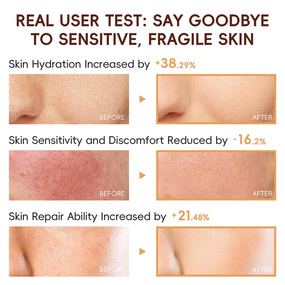 Crema de ojos de arroz EONFAVE: hidrata y suaviza la zona ocular