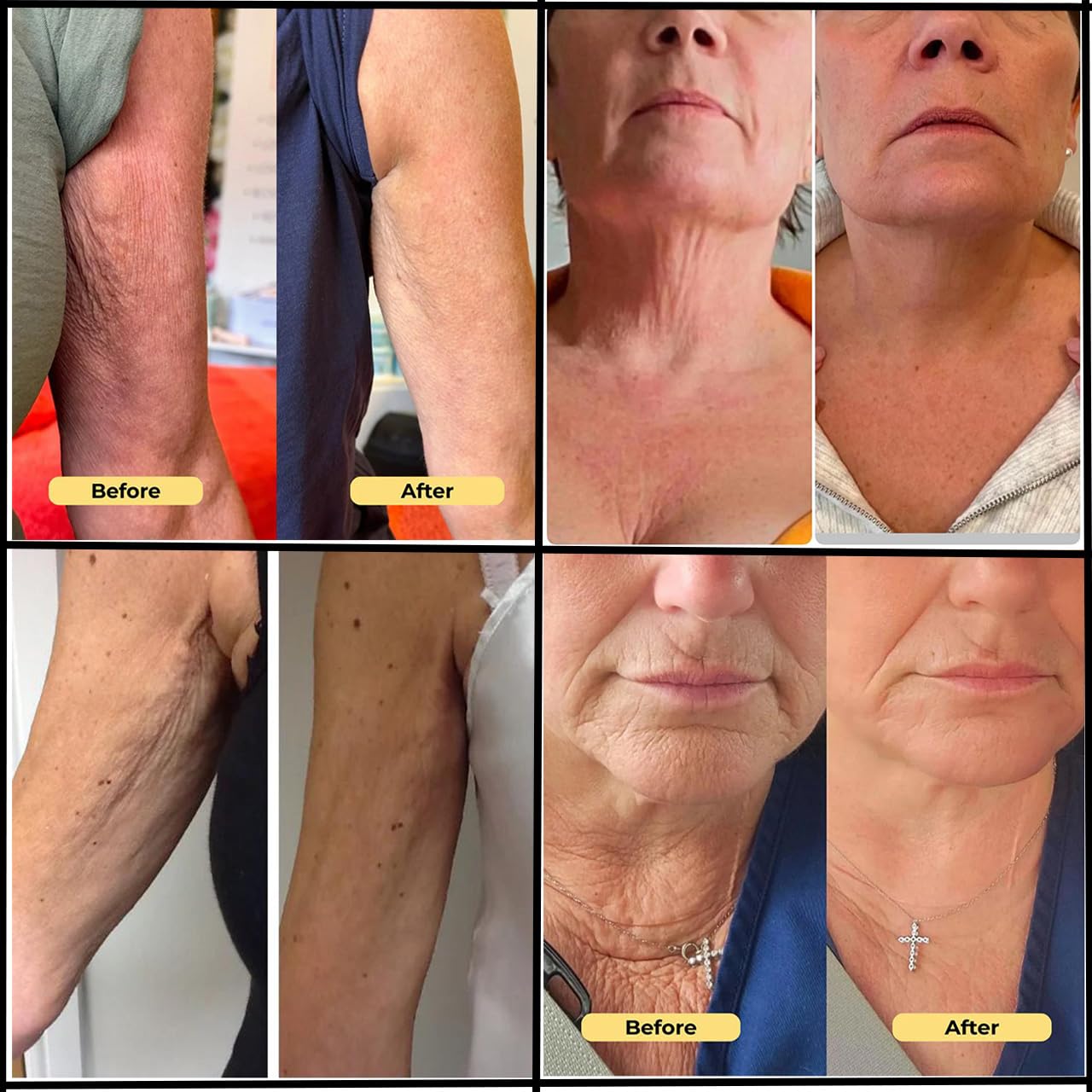 ERAE Queen Textura ligera se absorbe rápido sin dejar grasa