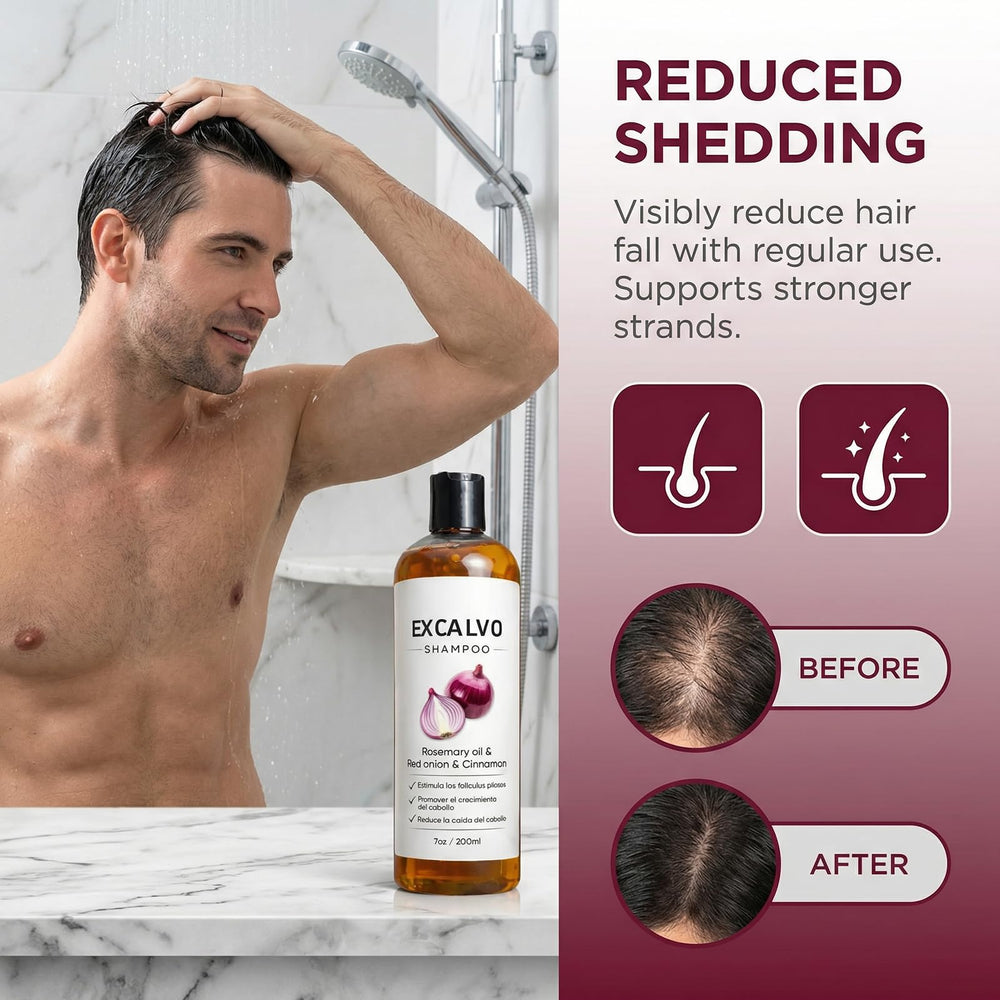 EXCALVO Shampoo Cebolla, canela destacada para equilibrio del cuero cabelludo.