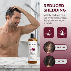 EXCALVO Shampoo Cebolla, canela destacada para equilibrio del cuero cabelludo.