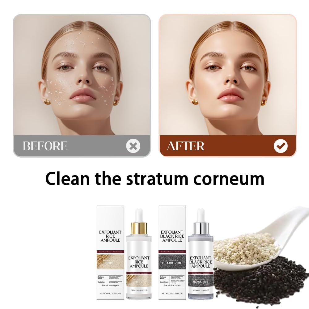 Exfoliante de Arroz Negro y Blanco, aplicado en rostro, ayuda a hidratación ligera.