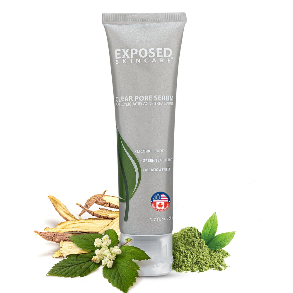 Exposed Skin Care envase del serum para una aplicación suave y control del acné.