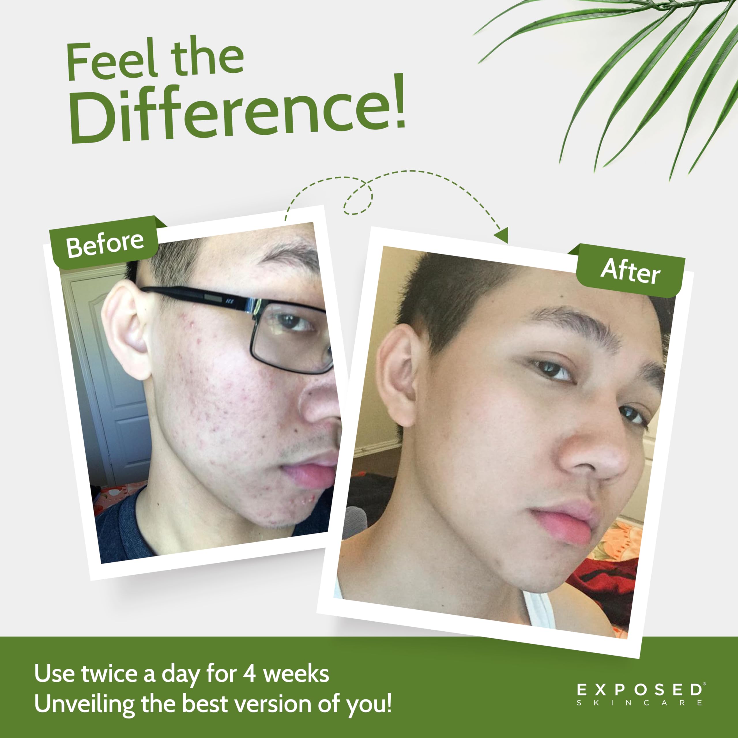 Exposed Skin Care ingredientes-te-verde aportan frescura y antioxidantes para piel más equilibrada.