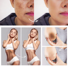 FAMIROSA Corrector de manchas para codos, piel más suave al tacto.