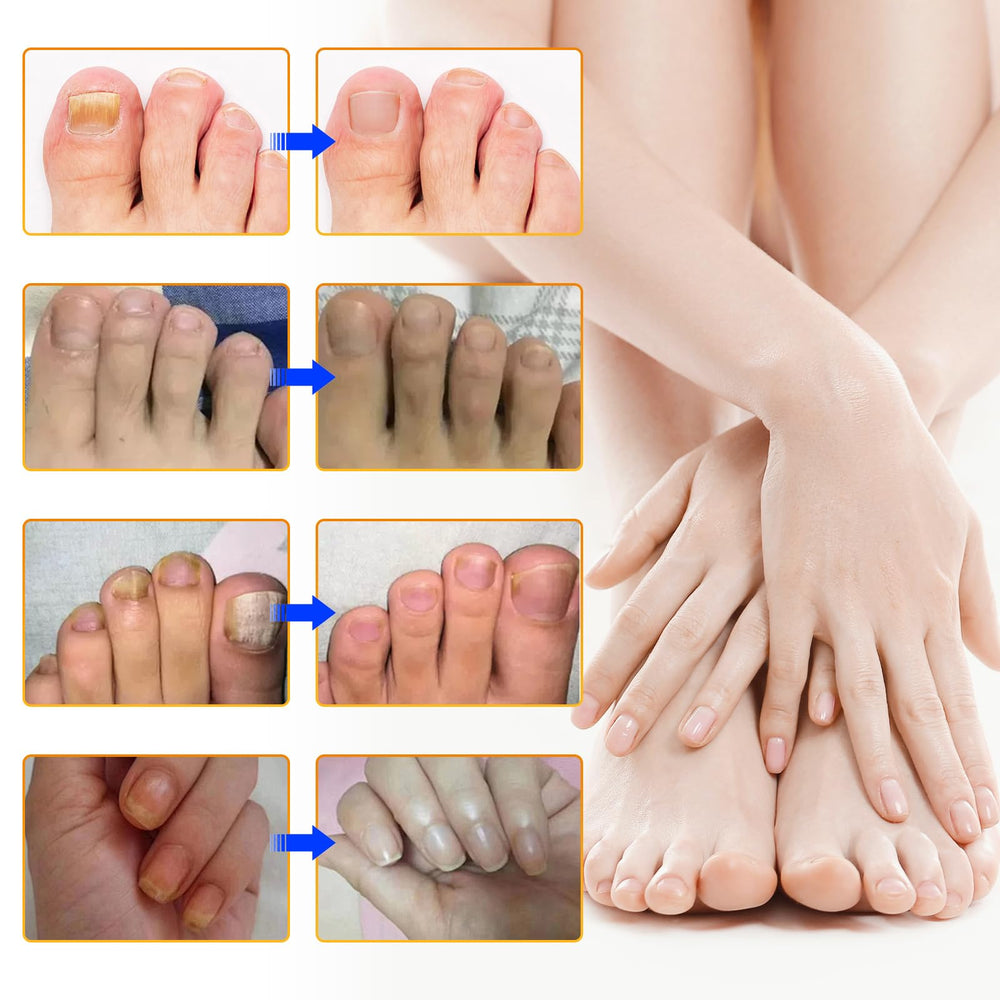 FANSHI apto para hombres y mujeres para el cuidado de uñas.