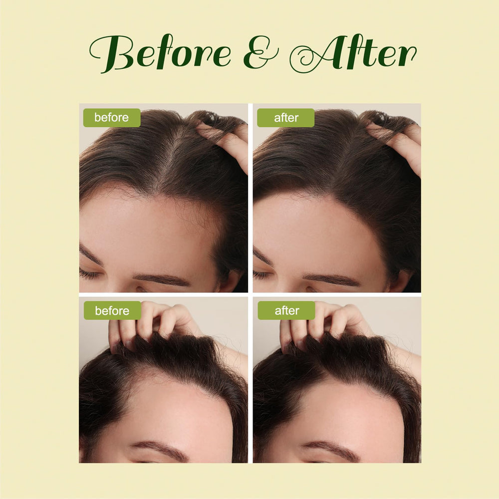 FEIBTH Aplicación masaje cabello: favorece la absorción y sensación de cuidado.