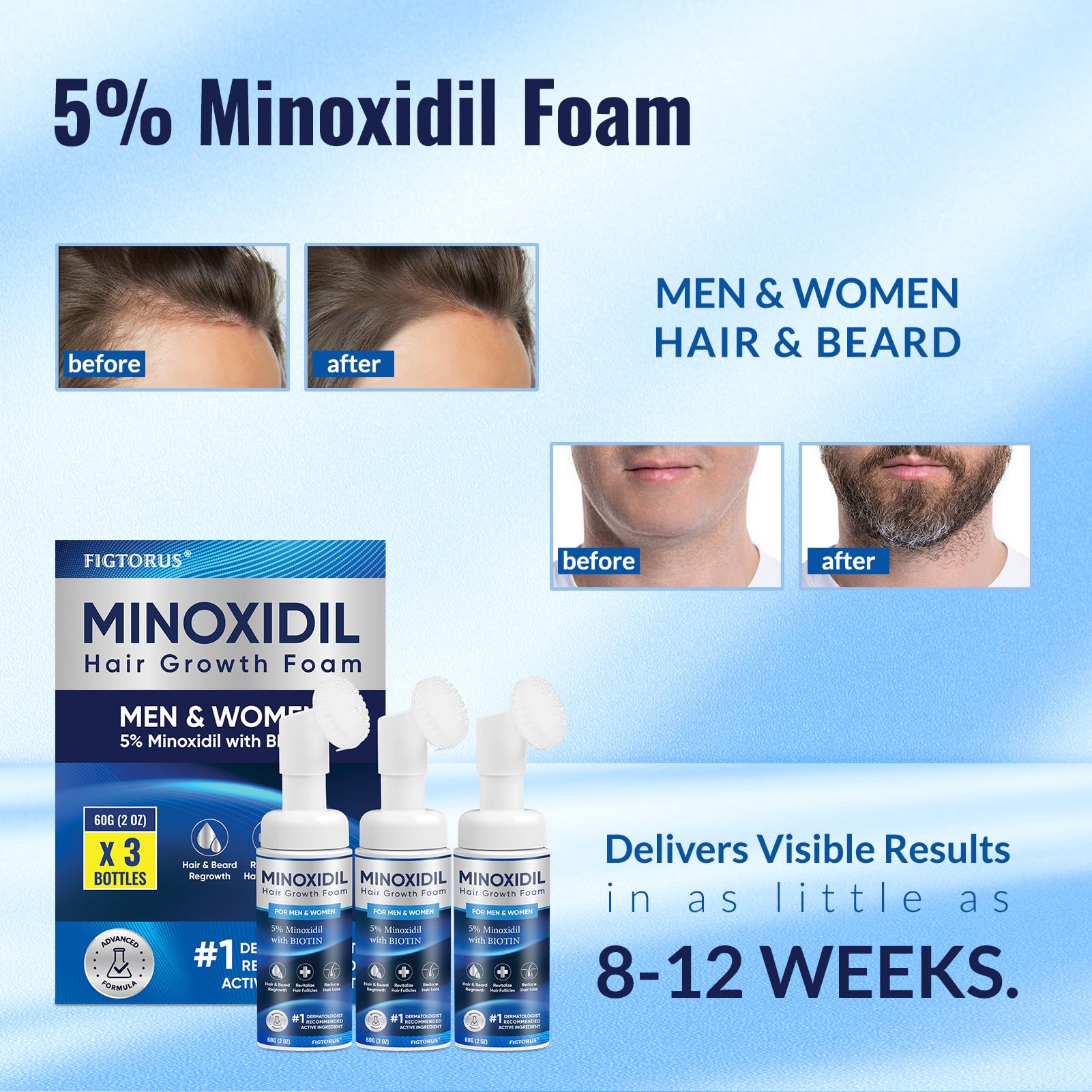 Figtorus Minoxidil Espuma aplicándose en cuero cabelludo, sensación de frescura.