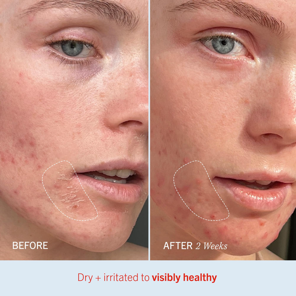 Piel más suave tras usar First Aid Beauty Crema Ultra Repair.