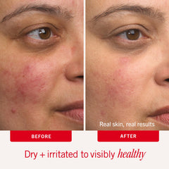 First Aid Beauty Ultra Repair Cream with ceramides promotes barrier restoration