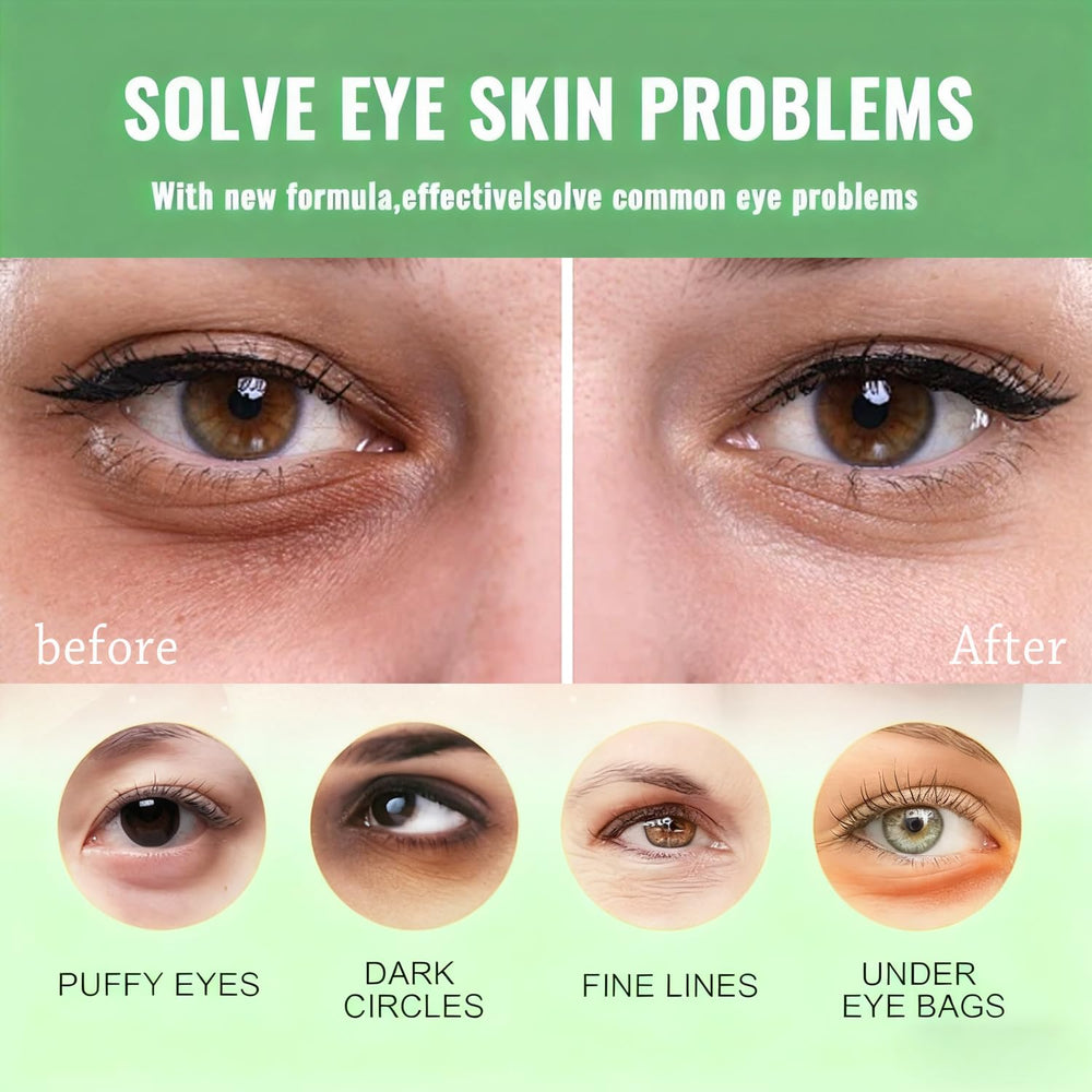 Firstfly mascarilla ojos aguacate, mejora elasticidad y nutrición del contorno.