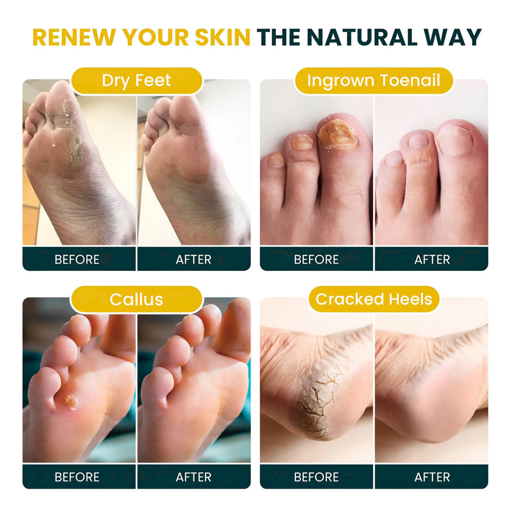 FOOT CURE fragancia arbol de te citrico en el baño