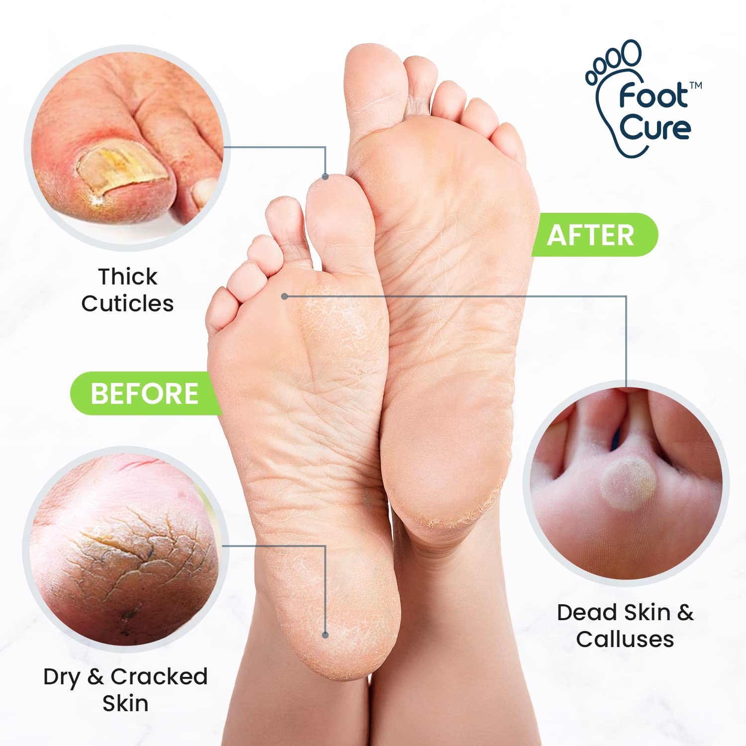 Remojo Foot Cure con sales de Epsom: relajación y talones más hidratados