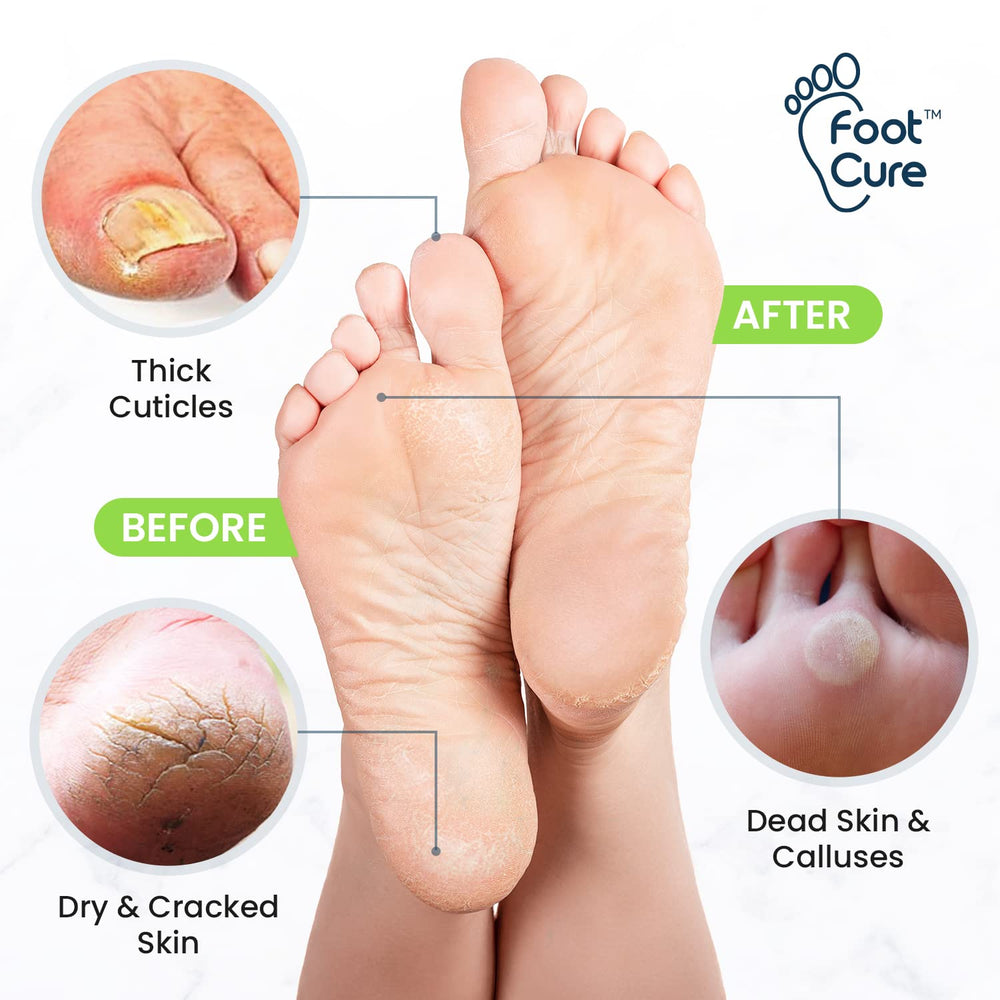 Remojo Foot Cure con sales de Epsom: relajación y talones más hidratados