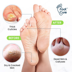 Remojo Foot Cure con sales de Epsom: relajación y talones más hidratados