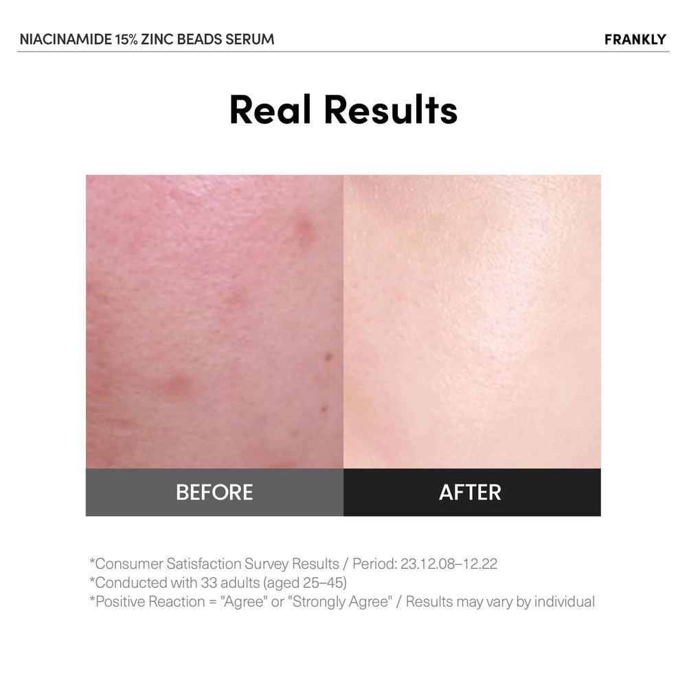 FRANKLY Niacinamida 15% + Zinc Serum, perlas encapsuladas, entrega fresca al contacto.