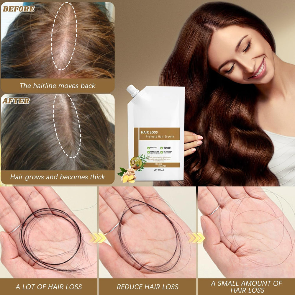Champú anti-caída Generic, cabello suave y brillante tras cada lavado.