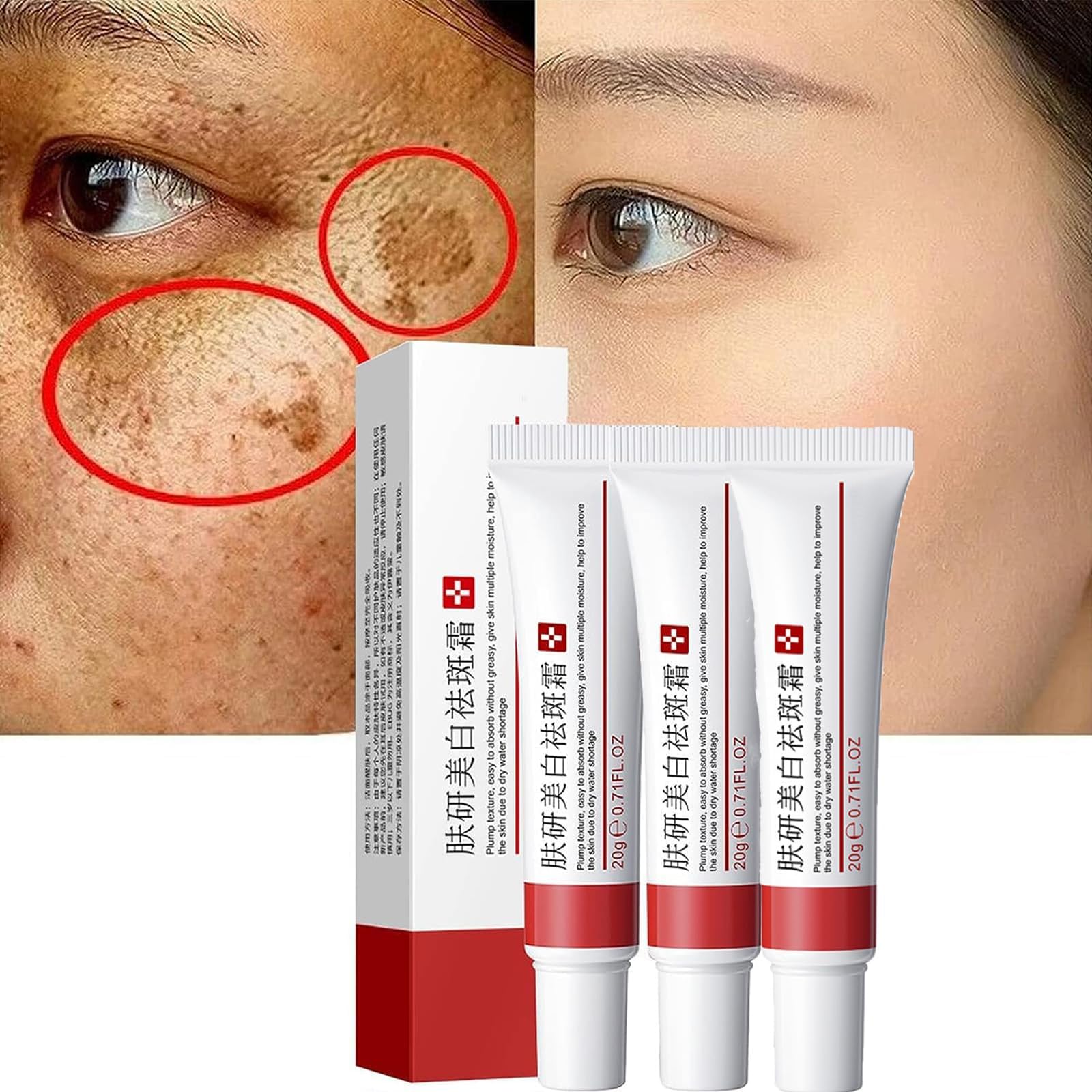 Generic crema para manchas en la cara, resultado semanal al suavizar el tono irregular.
