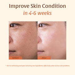 Generic jabon curcuma-brillo natural para revitalizar piel opaca.
