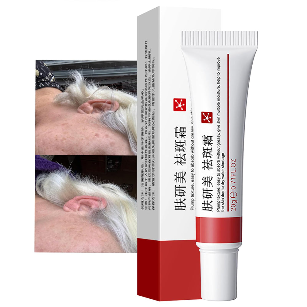Genérico crema para manchas oscuras en la cara, tono más uniforme.