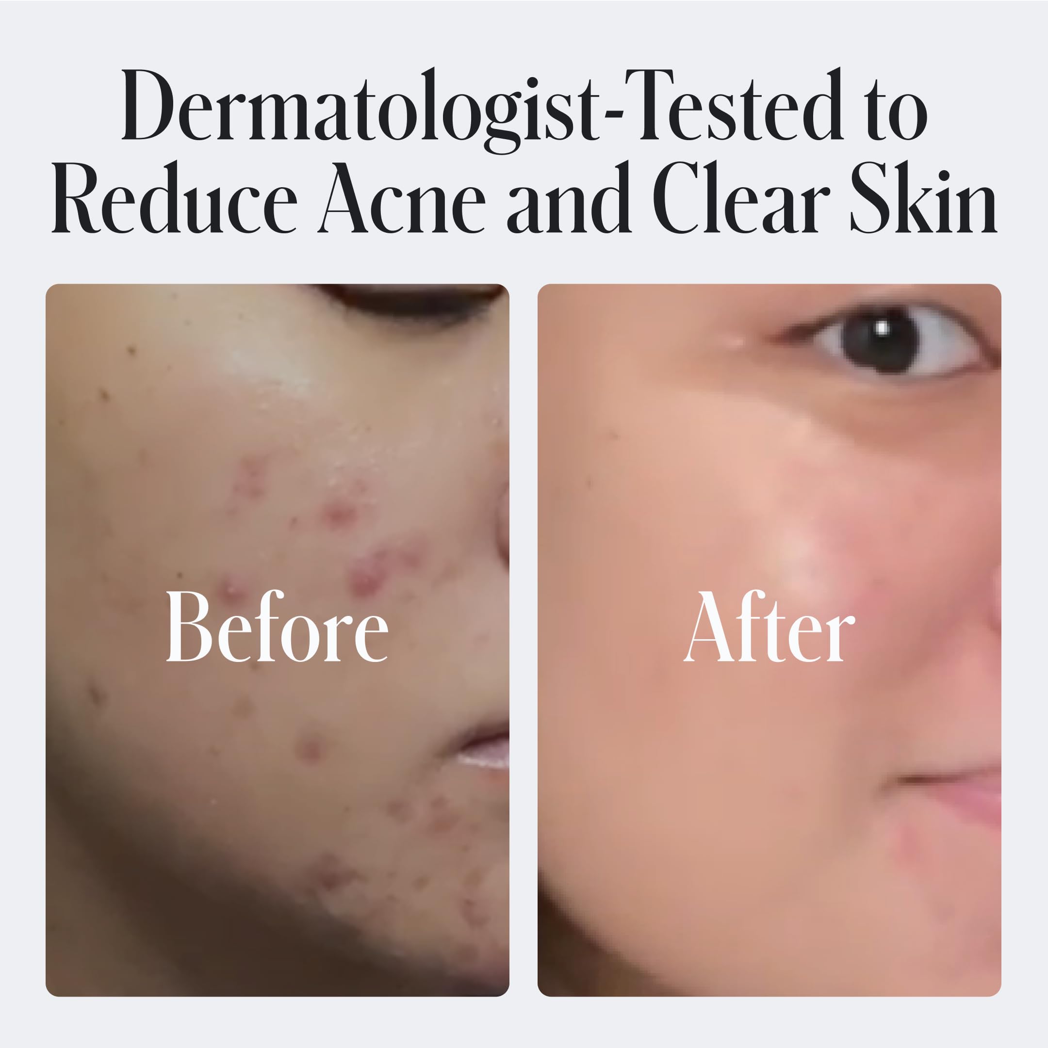 Geologie Daily Face Wash aplicación en la mano, piel limpia sin irritación