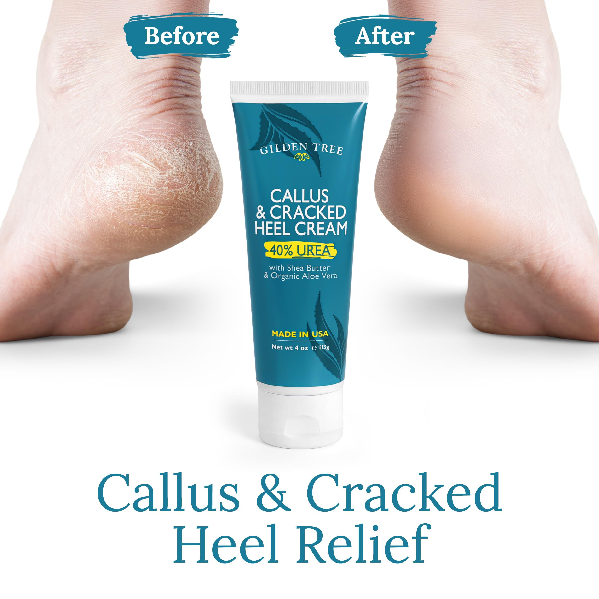 GILDEN TREE crema Urea 40% hidrata profundamente pies secos.