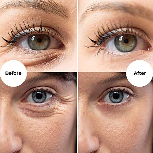 Gle Skincare serum de ojos, beneficios posibles para la zona delicada con cafeína y vitamina C.
