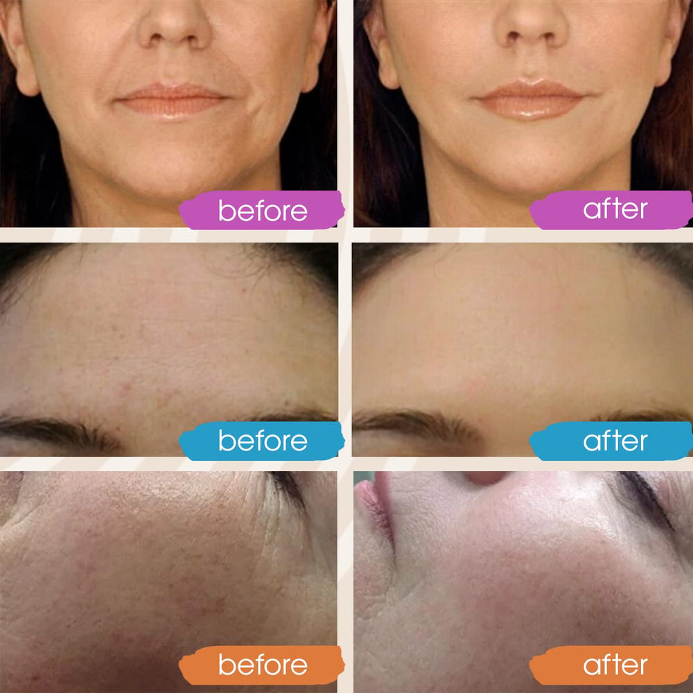 GLEOW suero noche con retinol, aplicación nocturna para renovación visible.