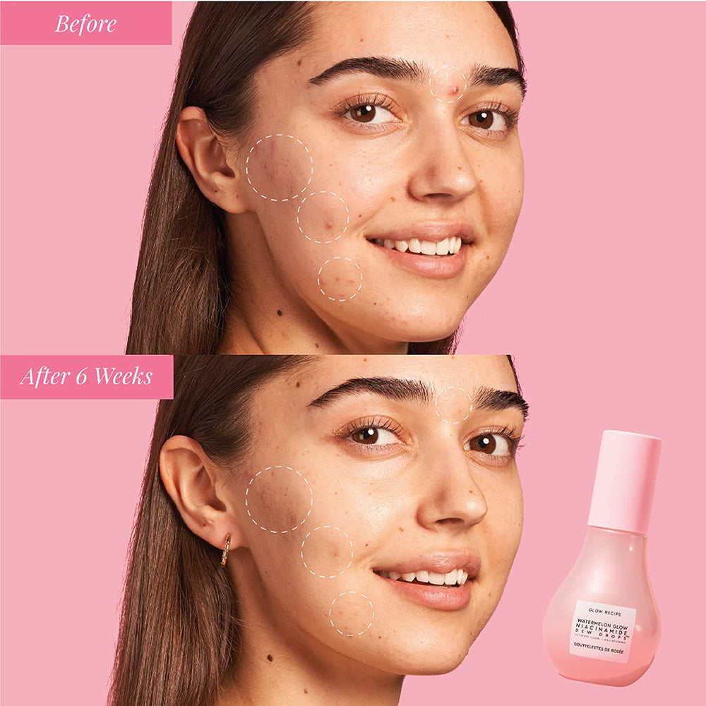 Glow Recipe Watermelon Niacinamide Dew Drops, ingrediente niacinamida destacado para la piel.