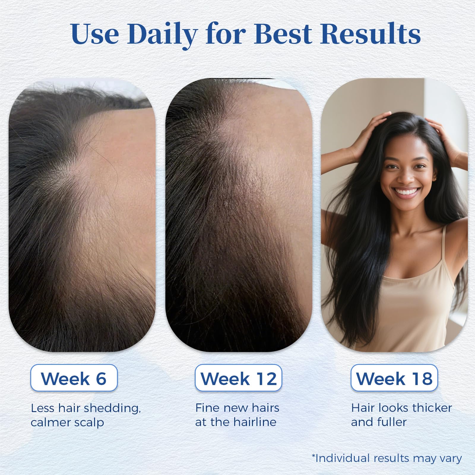 Gluvelessia serum capilar pack de 3 para cuidado continuo