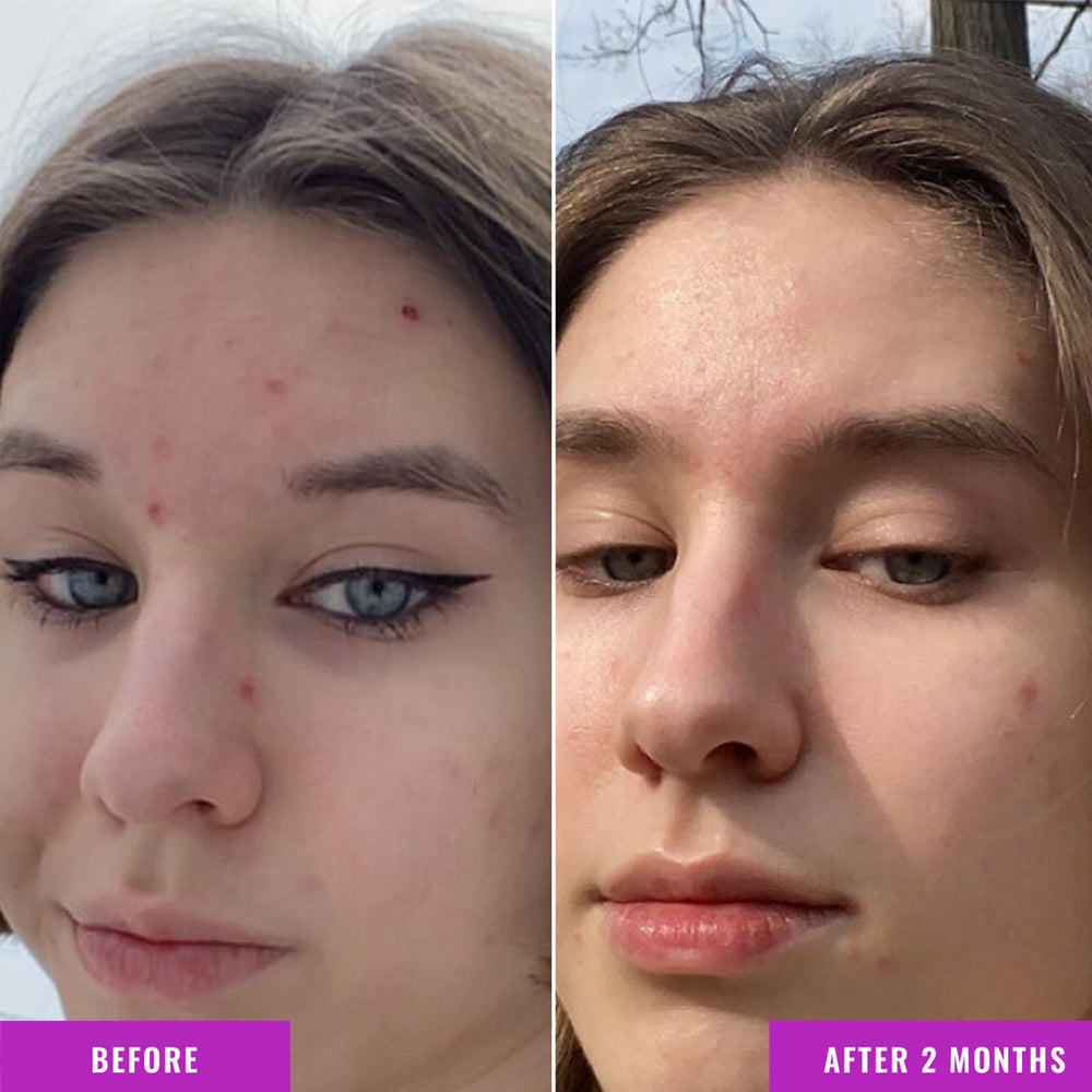 Good Molecules Niacinamida Serum, aplicación suave en la piel por la mañana.