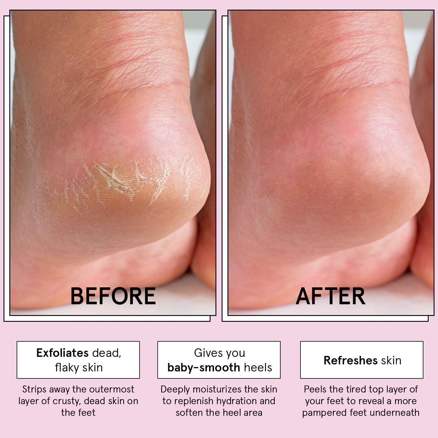 Aloe vera y 17 extractos vegetales cuidan la piel durante el exfoliado