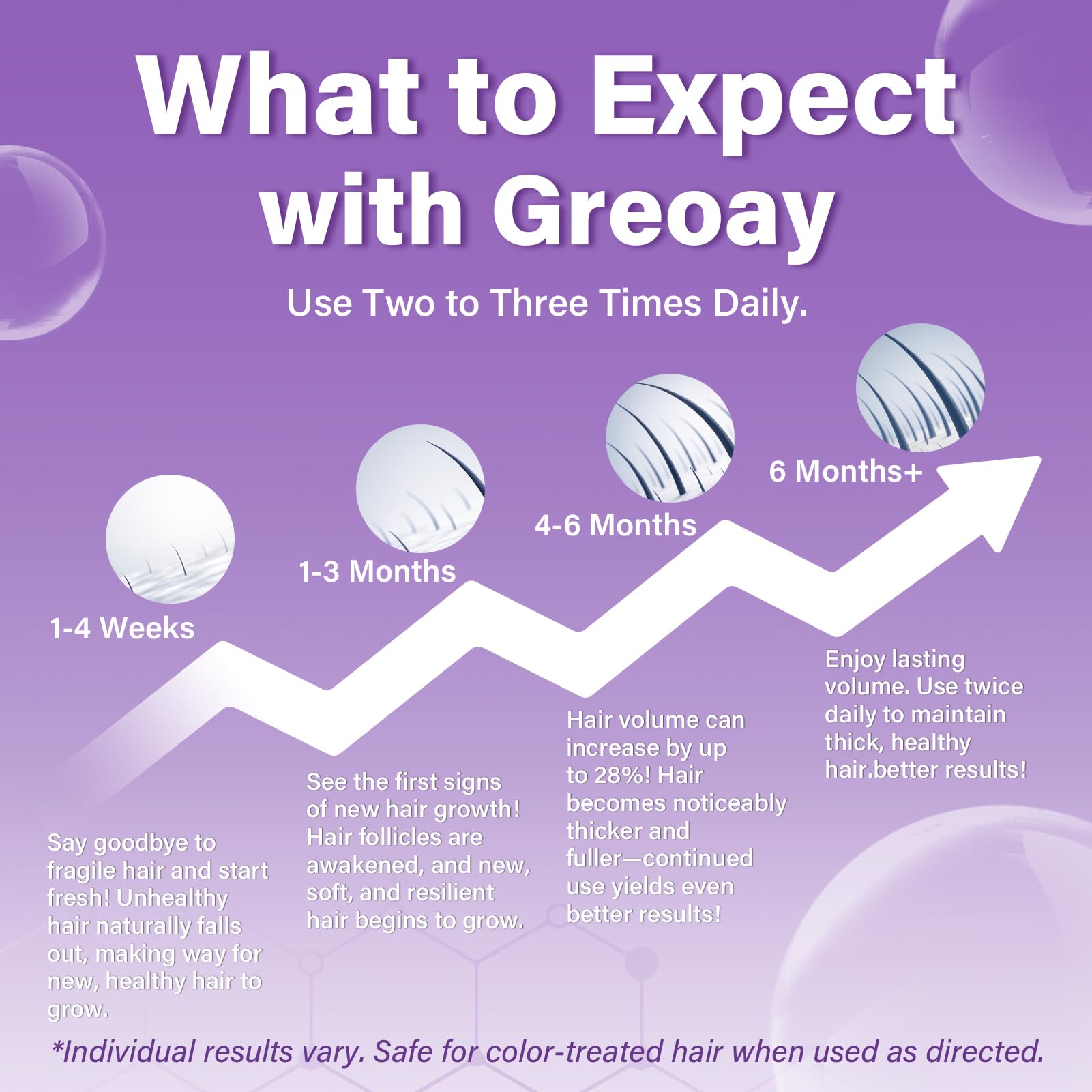 Greoay Espuma Minoxidil 5% para mujeres, aplicador en mano para aplicación suave.
