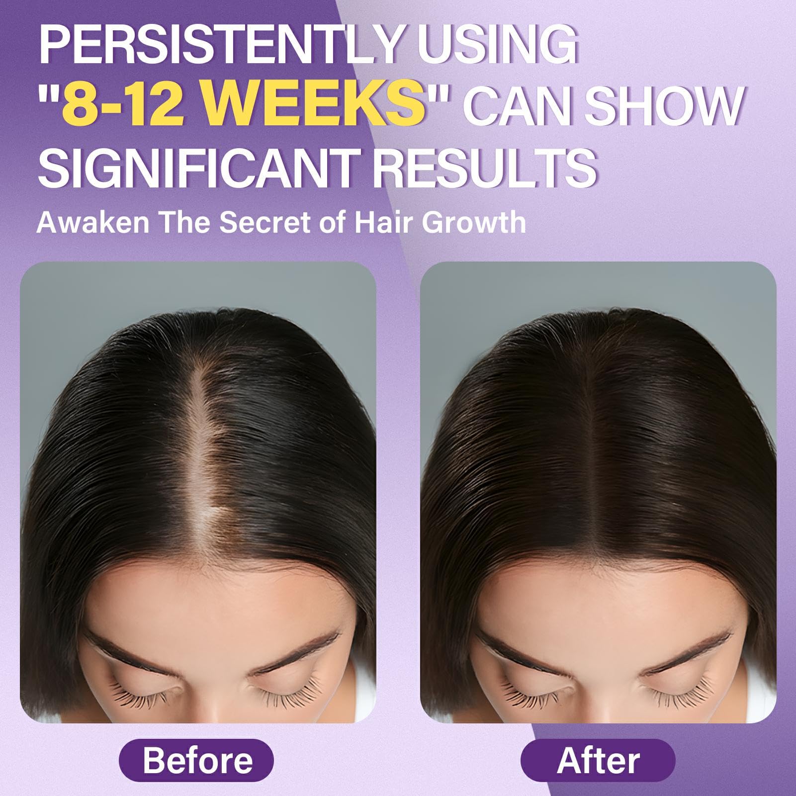 Greoay Minoxidil Espuma 5% para mujeres, bote visible sobre mesa, uso diario potencial.
