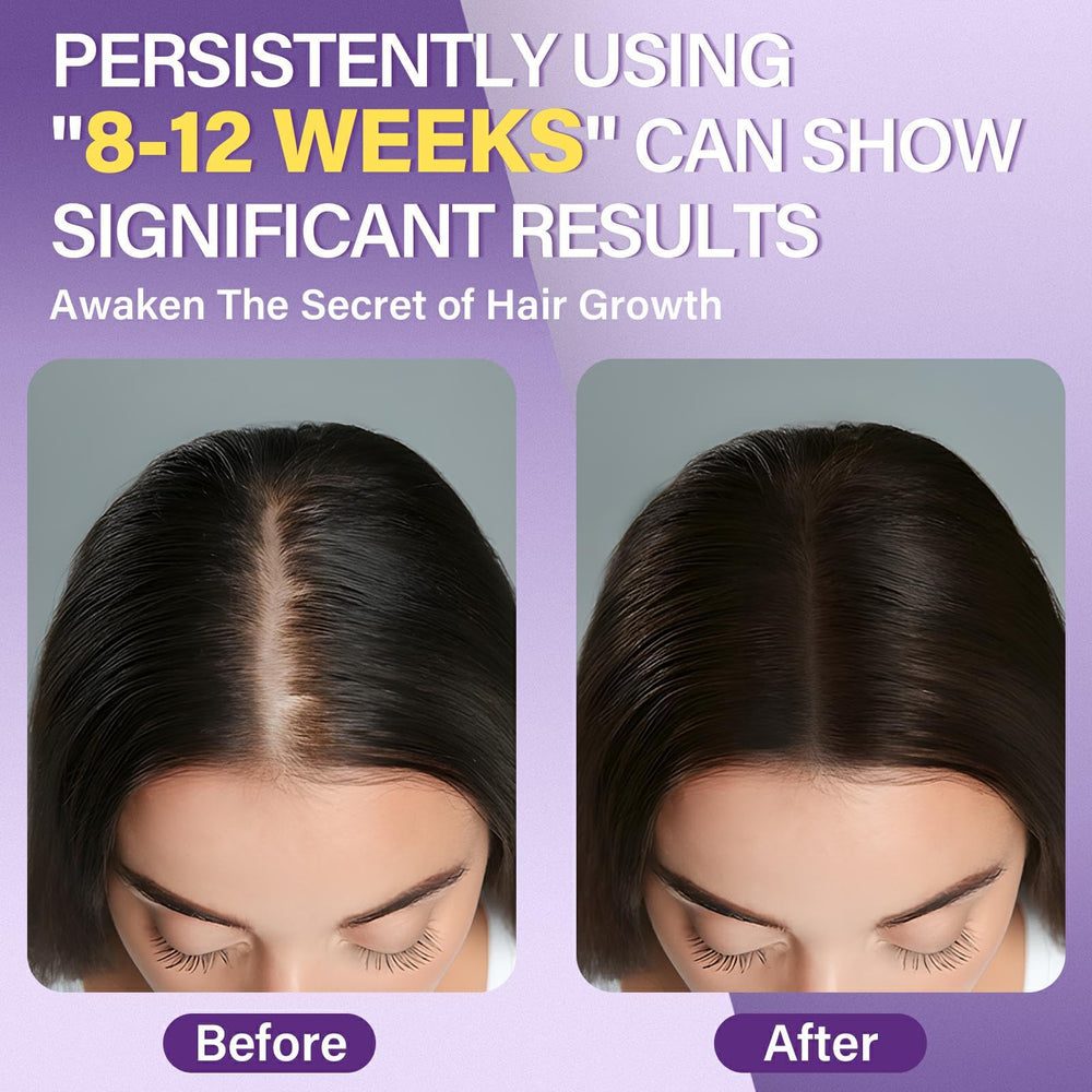 Greoay Minoxidil Espuma 5% para mujeres, bote visible sobre mesa, uso diario potencial.