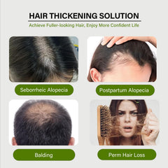 GURKOOYD ingredientes clave como ginseng y jengibre, nutren los folículos para un cabello más fuerte