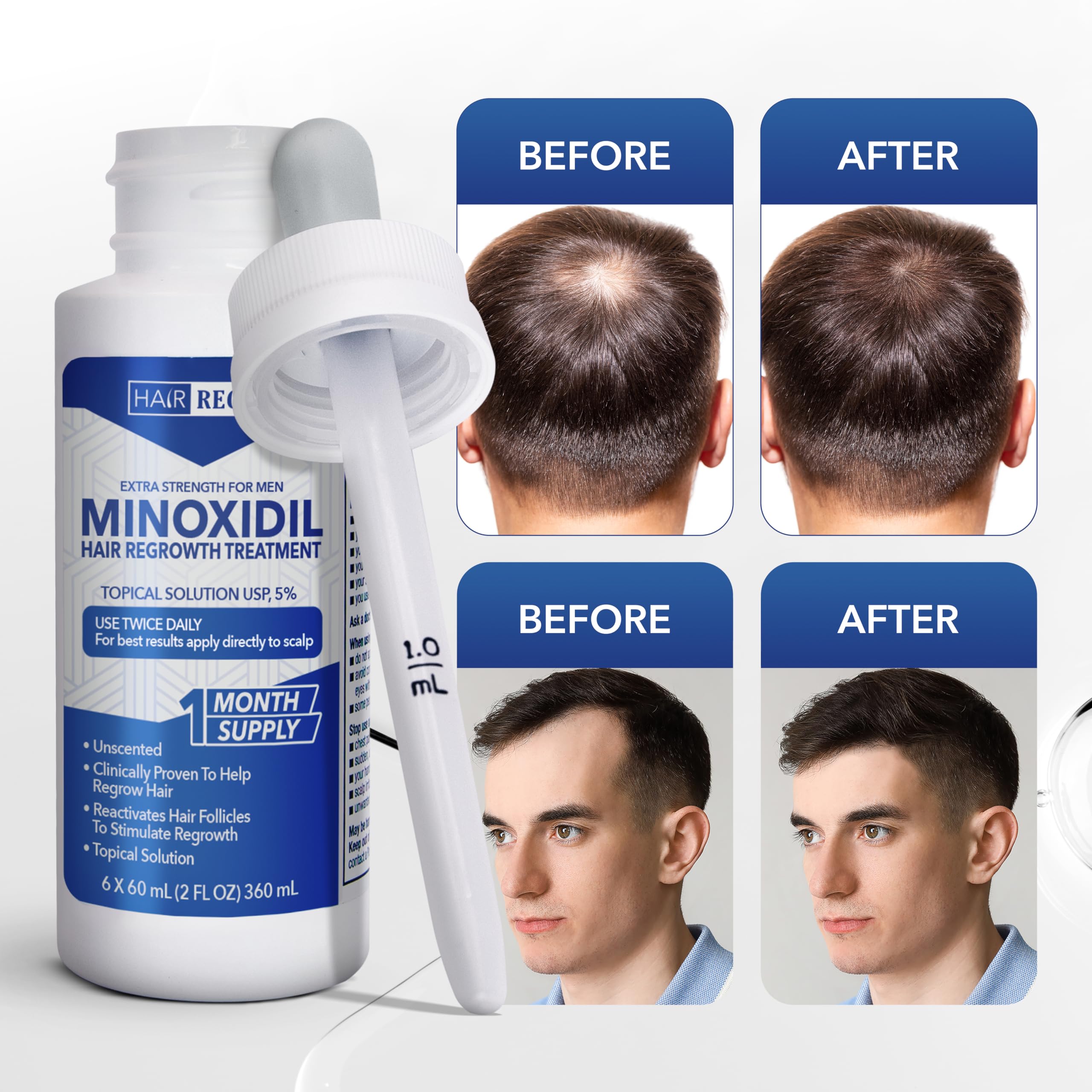 Hair Regen Minoxidil: aplicación diaria que favorece la densidad del cabello