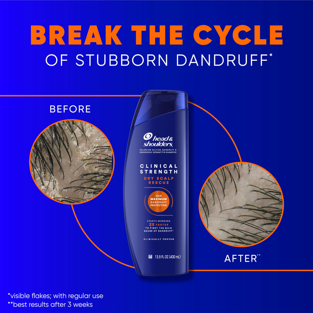Head & Shoulders dandruff-defense conditioner tube paired with shampoo