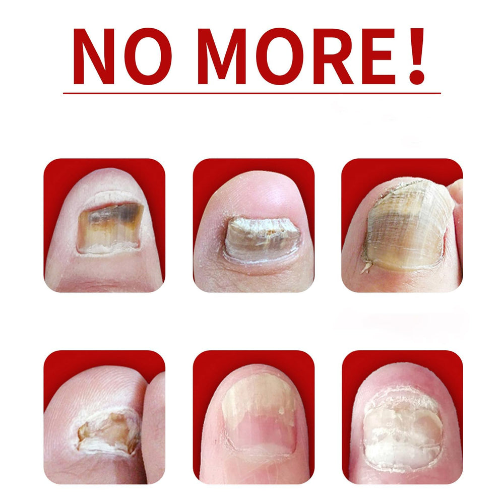 IMOLL Conjunto de 2 piezas para uñas con jengibre y cuidado práctico.