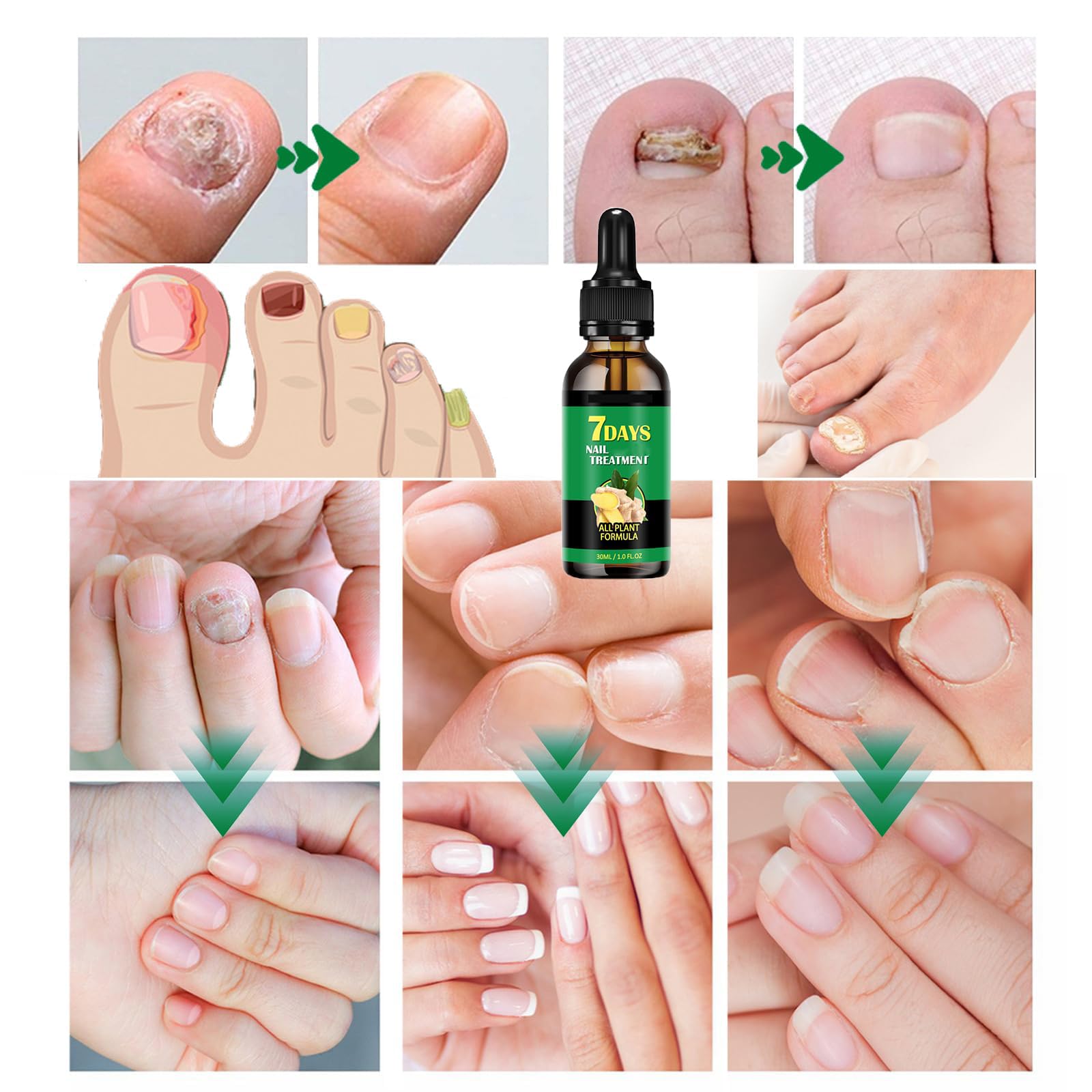 IMOLL Tratamiento de uñas con jengibre: aplicación en cutícula para nutrir.